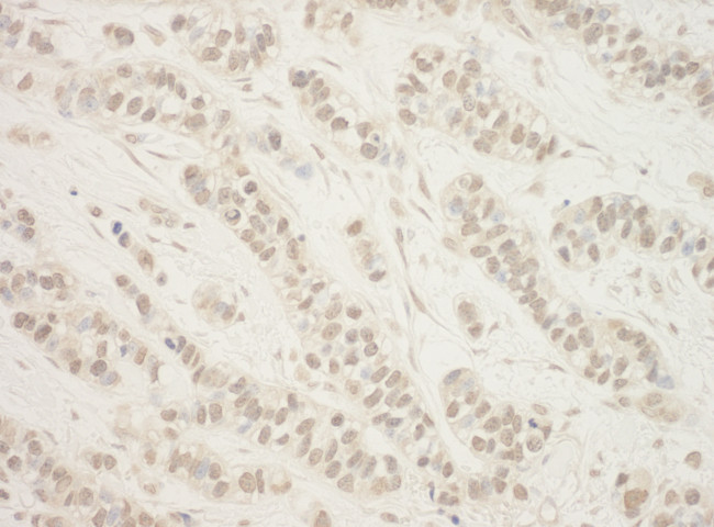 BHD Antibody in Immunohistochemistry (Paraffin) (IHC (P))