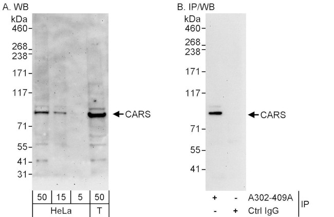 CARS Antibody in Western Blot (WB)