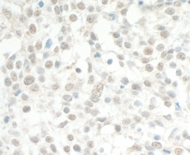 MED13L Antibody in Immunohistochemistry (Paraffin) (IHC (P))