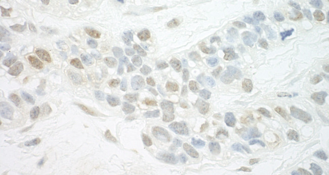 MED13L Antibody in Immunohistochemistry (Paraffin) (IHC (P))