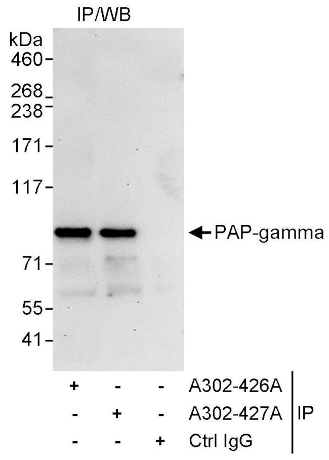 PAP-gamma Antibody in Immunoprecipitation (IP)