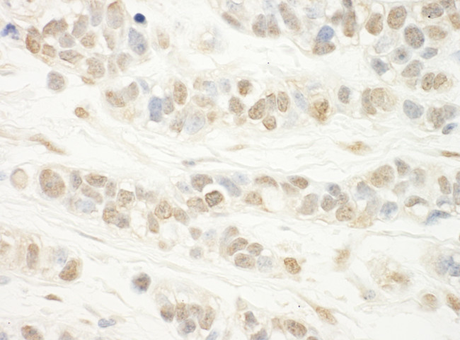 WDR5 Antibody in Immunohistochemistry (Paraffin) (IHC (P))