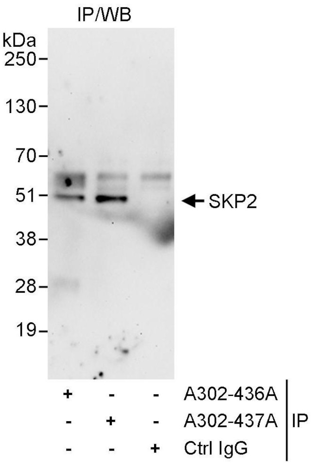 SKP2 Antibody in Immunoprecipitation (IP)