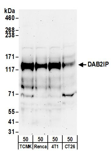 DAB2IP Antibody in Western Blot (WB)