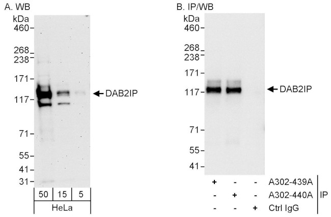 DAB2IP Antibody in Western Blot (WB)