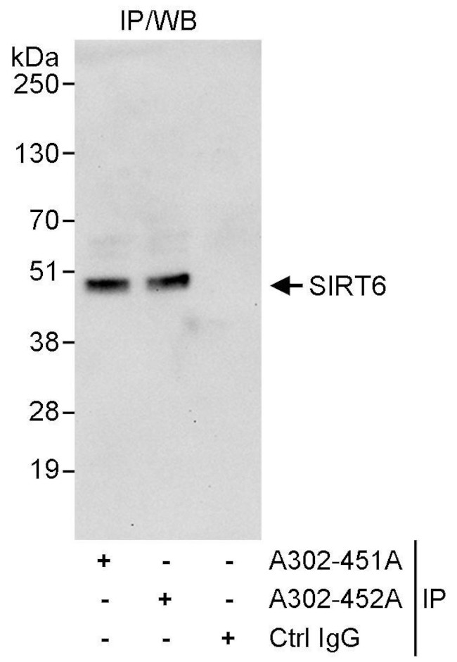 Sirt6 Antibody in Immunoprecipitation (IP)