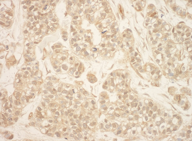 RSK2 Antibody in Immunohistochemistry (Paraffin) (IHC (P))