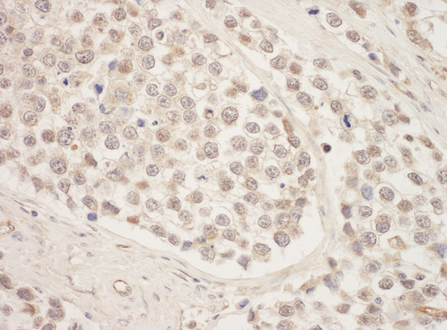 SRPK1 Antibody in Immunohistochemistry (Paraffin) (IHC (P))