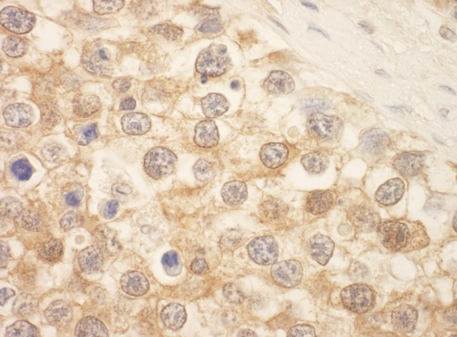 SPAK Antibody in Immunohistochemistry (Paraffin) (IHC (P))