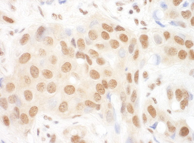 DGCR8 Antibody in Immunohistochemistry (Paraffin) (IHC (P))