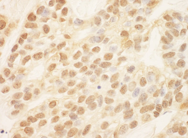 ZEB2/SIP Antibody in Immunohistochemistry (Paraffin) (IHC (P))