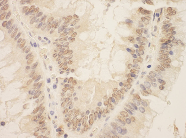 ZEB2/SIP Antibody in Immunohistochemistry (Paraffin) (IHC (P))