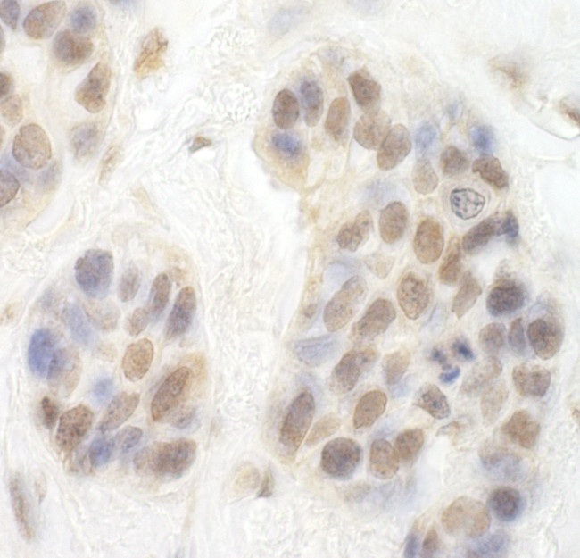 CDK8 Antibody in Immunohistochemistry (Paraffin) (IHC (P))