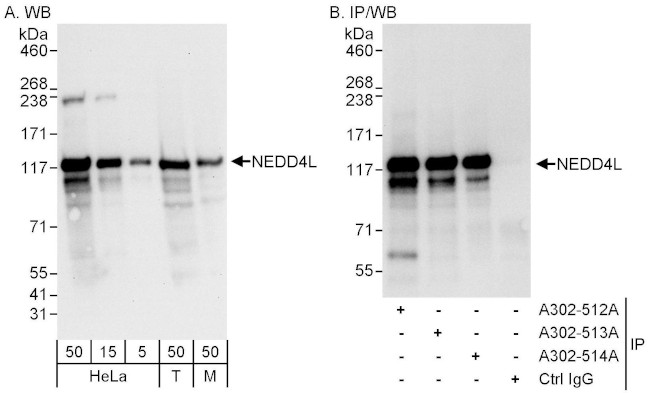 NEDD4L Antibody in Western Blot (WB)