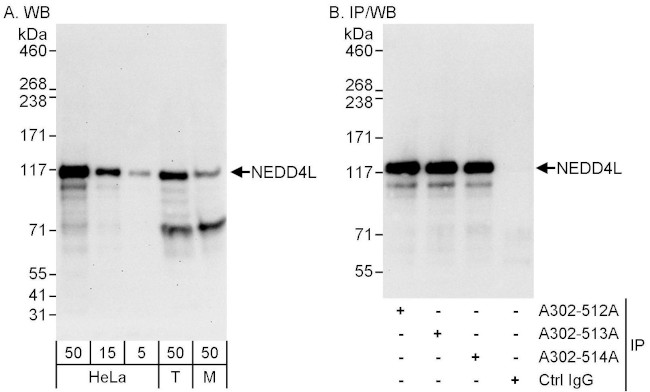 NEDD4L Antibody in Western Blot (WB)