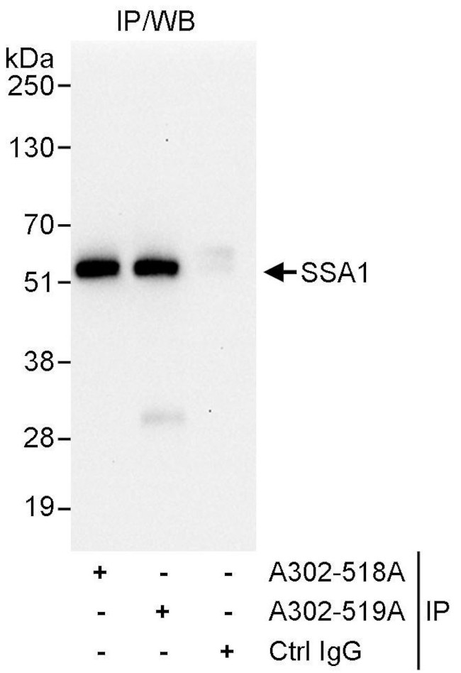 SSA1 Antibody in Immunoprecipitation (IP)