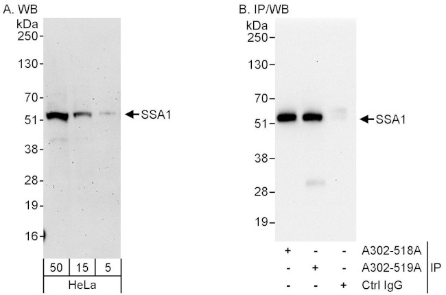 SSA1 Antibody in Western Blot (WB)