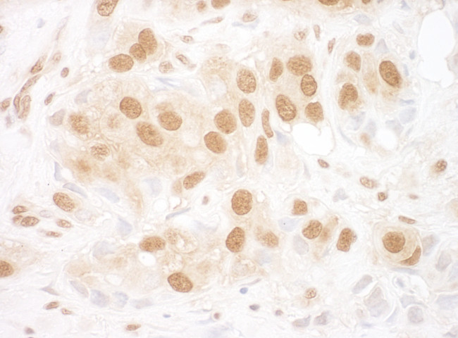 RuvBL2 Antibody in Immunohistochemistry (Paraffin) (IHC (P))