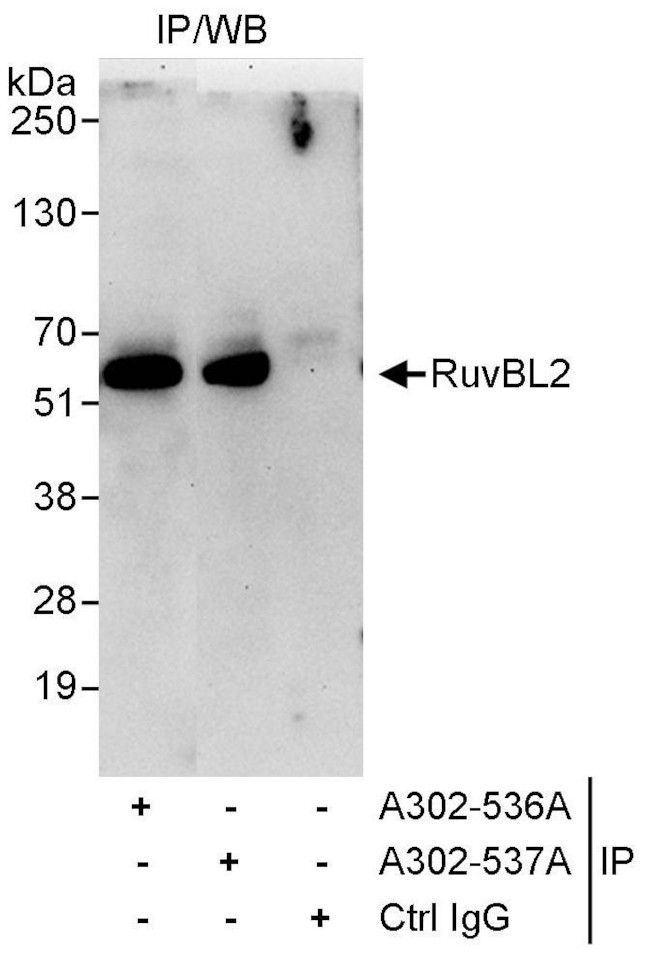 RuvBL2 Antibody in Immunoprecipitation (IP)