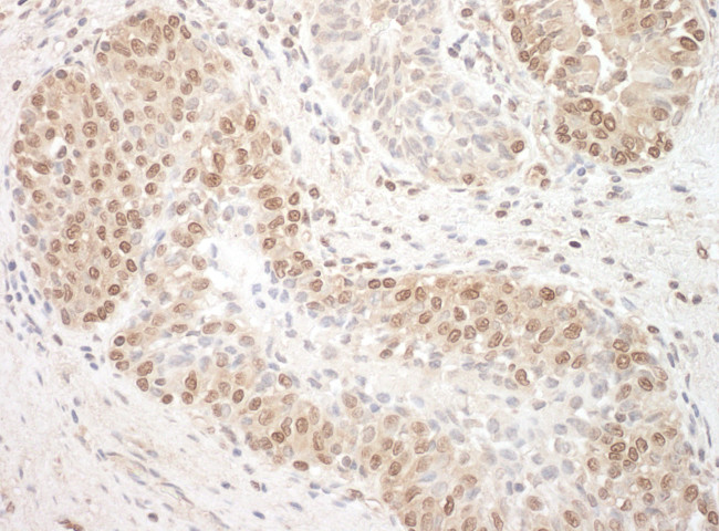 TFIP11 Antibody in Immunohistochemistry (Paraffin) (IHC (P))