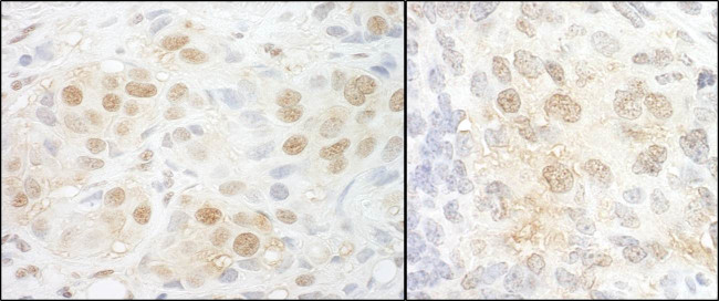 NCBP2 Antibody in Immunohistochemistry (Paraffin) (IHC (P))