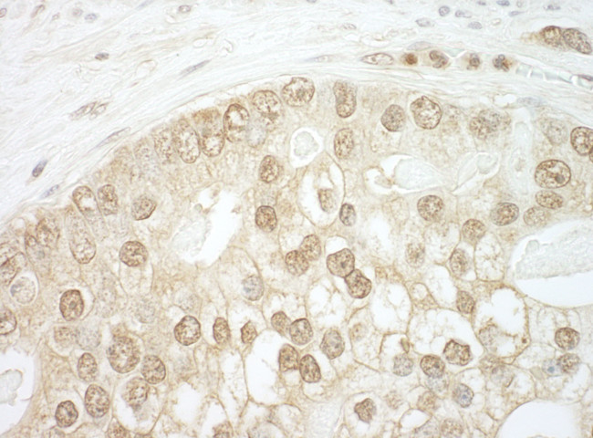 CNOT2 Antibody in Immunohistochemistry (Paraffin) (IHC (P))