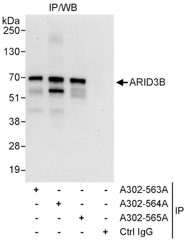 ARID3B Antibody in Immunoprecipitation (IP)