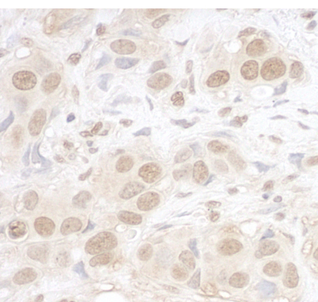 ARID3B Antibody in Immunohistochemistry (Paraffin) (IHC (P))