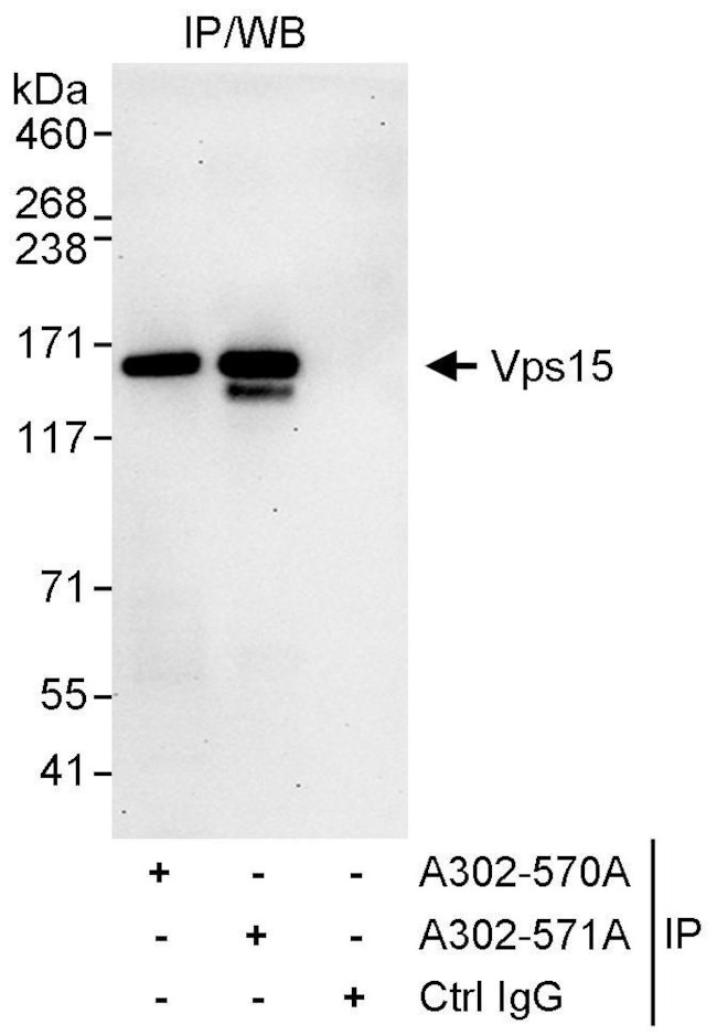 Vps15 Antibody in Immunoprecipitation (IP)