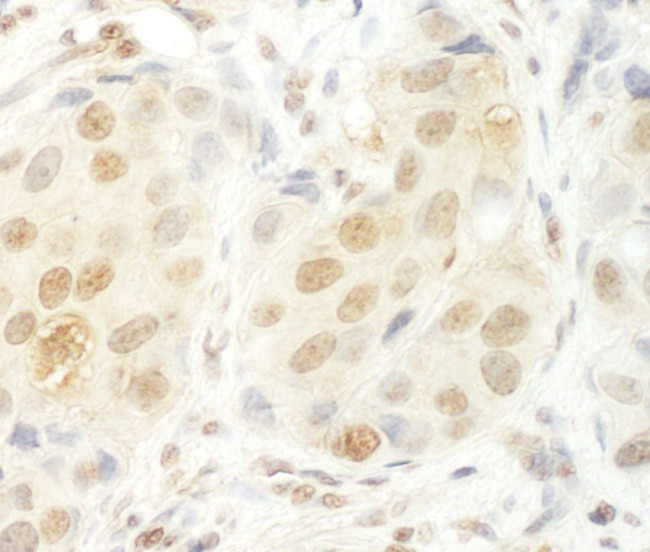 HCA66 Antibody in Immunohistochemistry (Paraffin) (IHC (P))