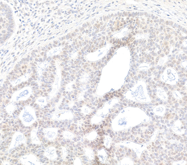 BRD2 Antibody in Immunohistochemistry (Paraffin) (IHC (P))