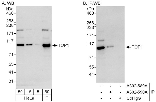 TOP1 Antibody in Western Blot (WB)