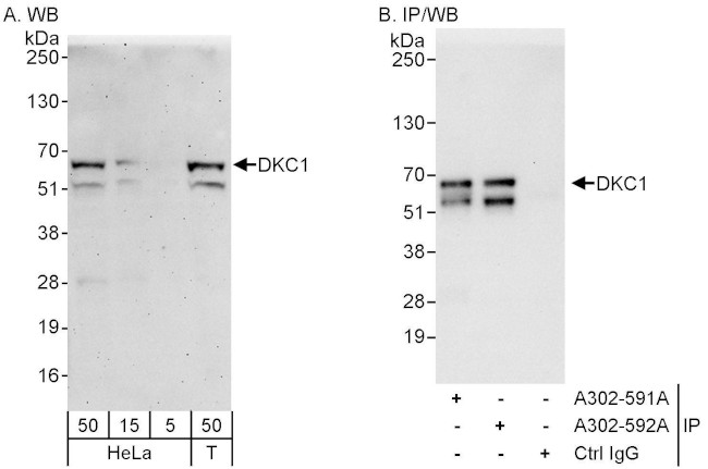 DKC1 Antibody in Western Blot (WB)