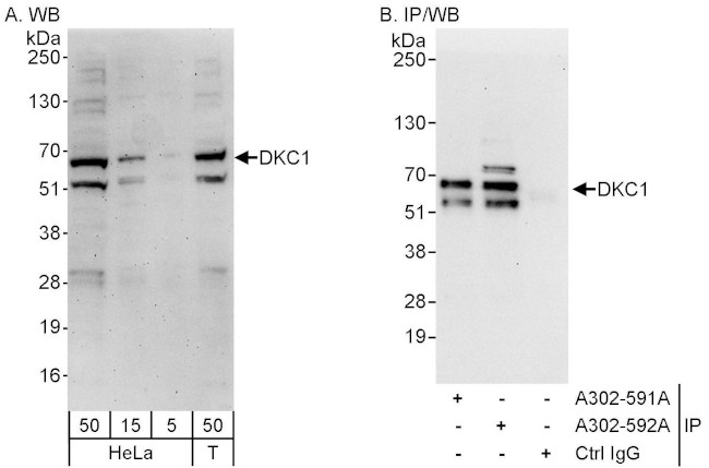 DKC1 Antibody in Western Blot (WB)