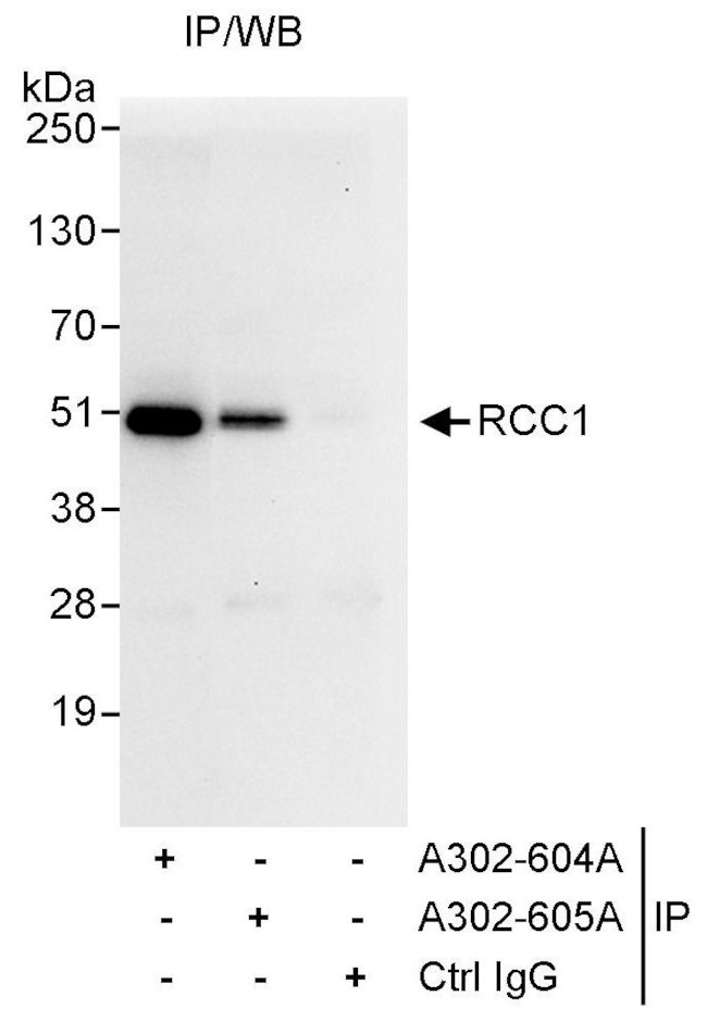 RCC1 Antibody in Immunoprecipitation (IP)