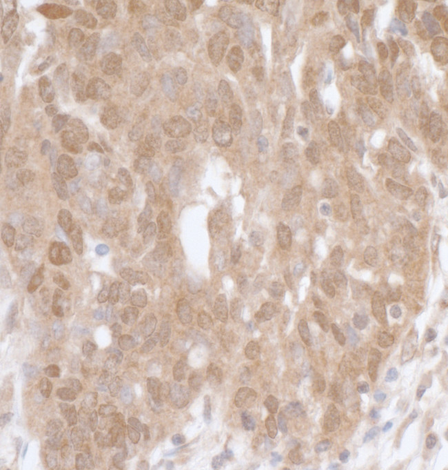 MK5 Antibody in Immunohistochemistry (Paraffin) (IHC (P))