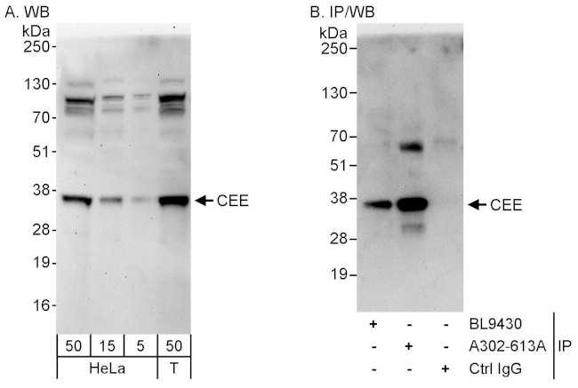 CEE Antibody in Western Blot (WB)