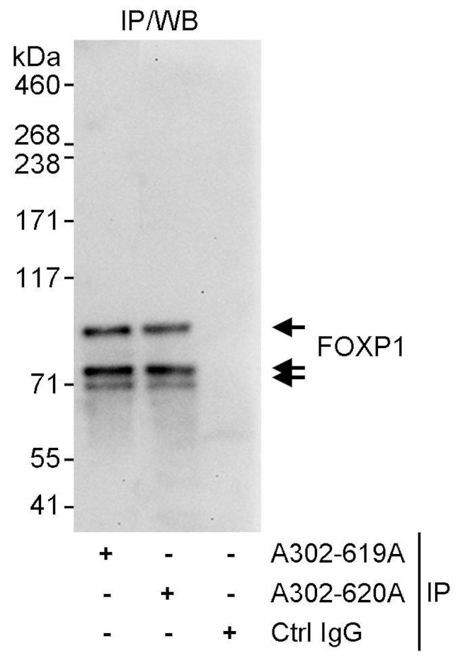 FOXP1 Antibody in Immunoprecipitation (IP)