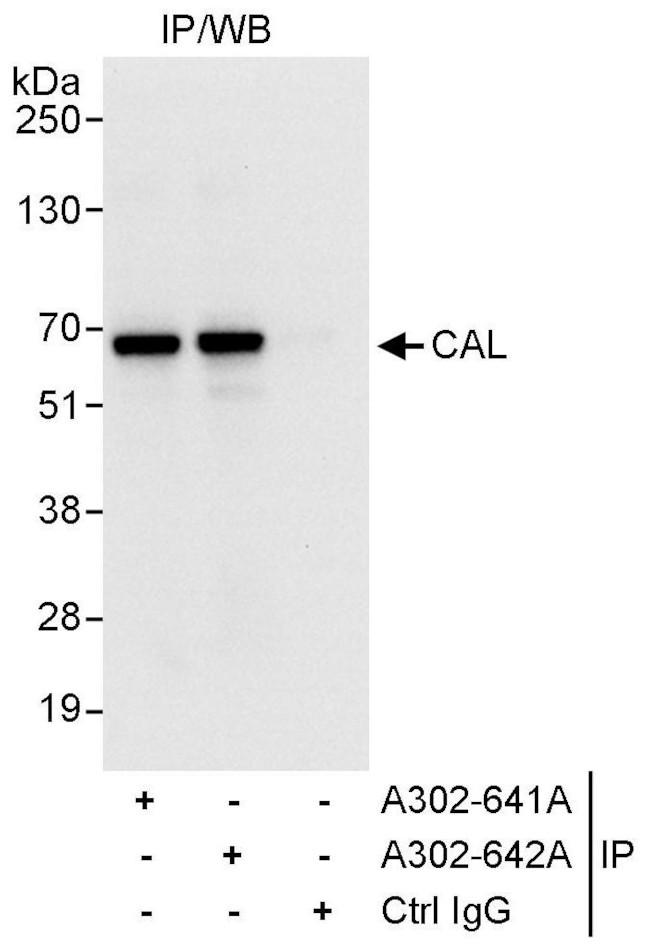 CAL Antibody in Immunoprecipitation (IP)