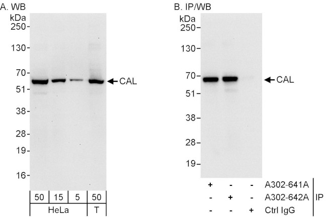 CAL Antibody in Western Blot (WB)