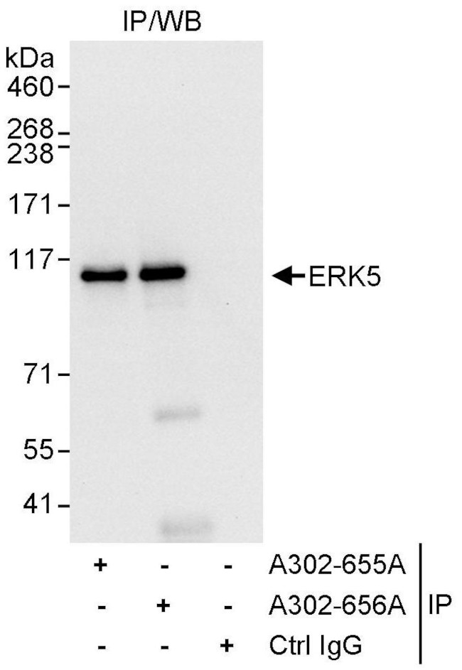 ERK5 Antibody in Immunoprecipitation (IP)