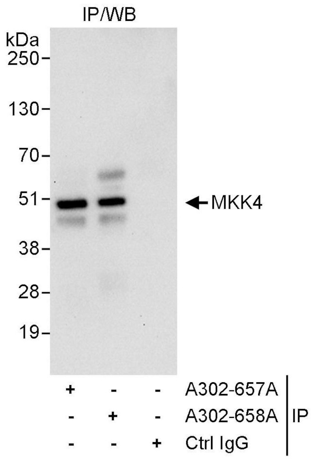 MKK4 Antibody in Immunoprecipitation (IP)