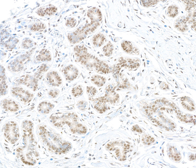 MTMR15 Antibody in Immunohistochemistry (Paraffin) (IHC (P))