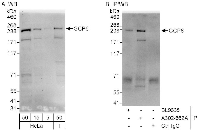 GCP6 Antibody in Western Blot (WB)