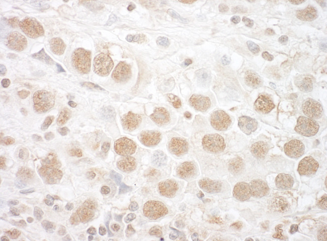 CTNNBL1 Antibody in Immunohistochemistry (Paraffin) (IHC (P))