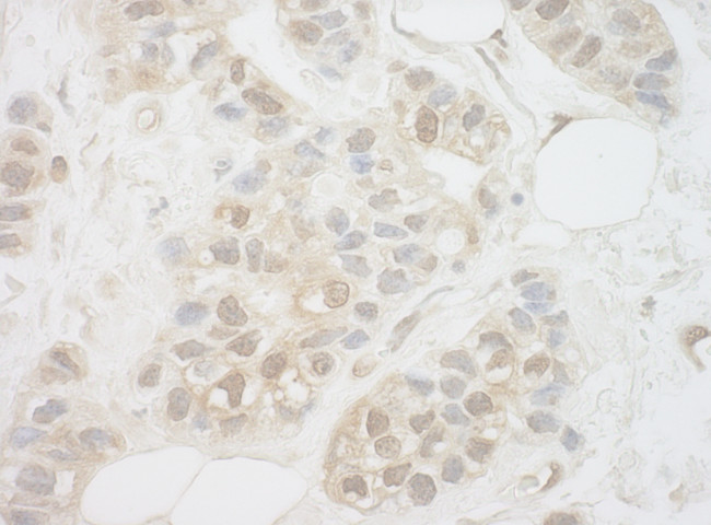 UCKL1 Antibody in Immunohistochemistry (Paraffin) (IHC (P))