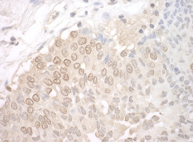 UCKL1 Antibody in Immunohistochemistry (Paraffin) (IHC (P))