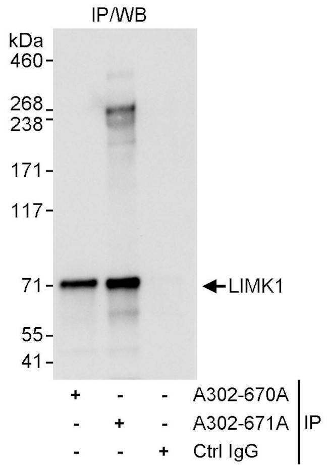 LIMK1 Antibody in Immunoprecipitation (IP)