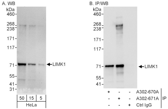 LIMK1 Antibody in Western Blot (WB)