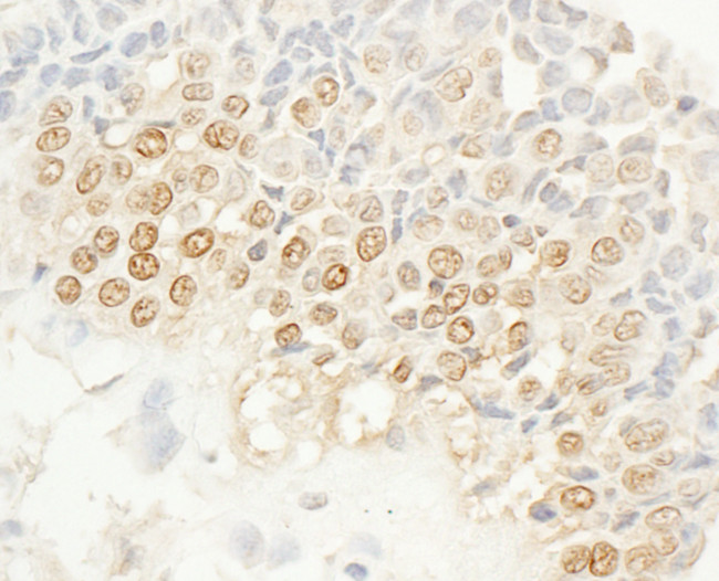 NEK4 Antibody in Immunohistochemistry (Paraffin) (IHC (P))